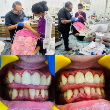 Understanding the Importance of Gum Health for Smokers and Overall Oral Well-being