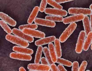 Why Is Plague Suddenly in the News Again? The Story From Russia