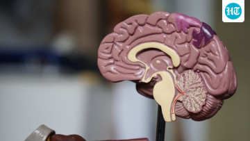 Gym Bros Train Their Bodies, But Who’s Training the Brain? 🧠 Doctor Explains Why Mental Fitness Is the Real Secret Behind Peak Performance